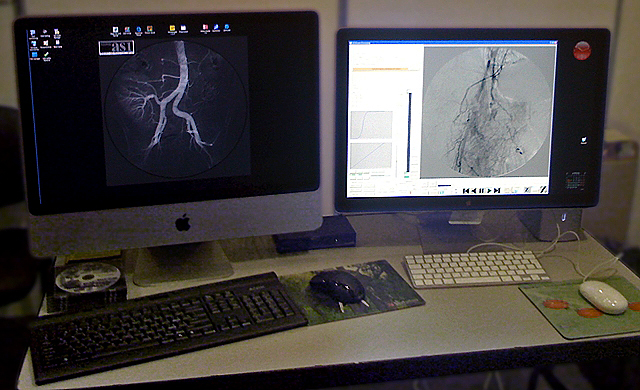 -  DICOM  Michelangelo   iMac 24. Dual-monitor DICOM workstation Michelangelo (iMac 24 + LED Cinema 24).
